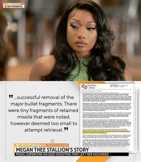 megan thee stallion injuries|megan the stallion 2022 hits.